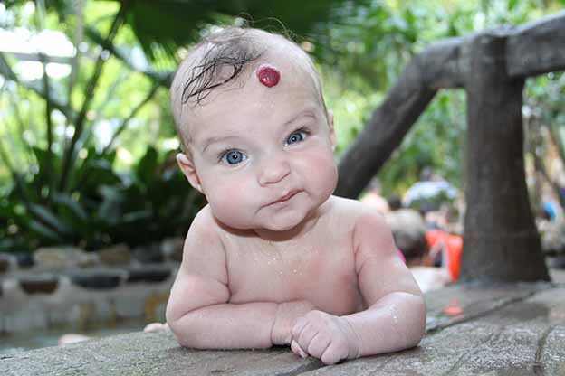 Aardbeienvlekje op voorhoofd baby