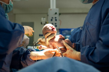 Baby geboren via een keizersnede