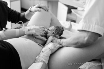 Geboortefotografie baby wordt geboren
