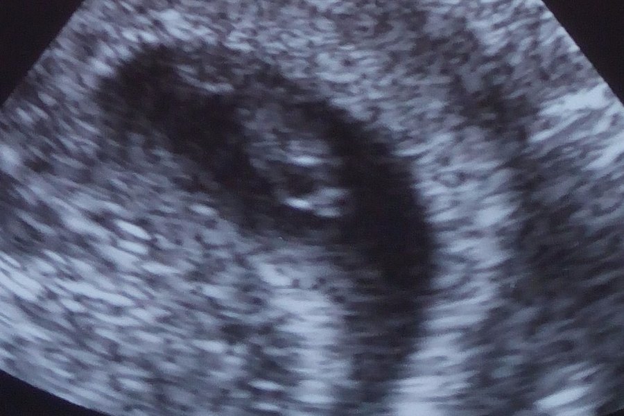 echo baby 8 weken - blogger m