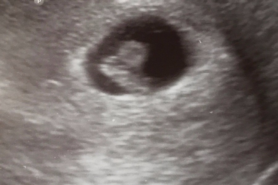 echo_bij_het_hartje_klopt