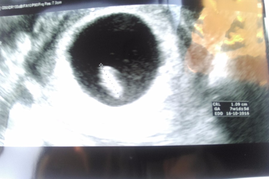 echo_van_blogger eva_