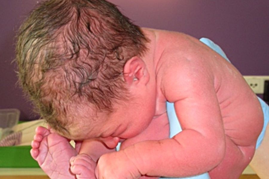 Zoon van blogger Renee vlak na zijn geboorte