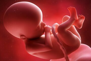 Foetus