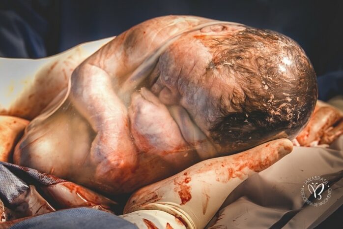 Pasgeboren baby zit nog in foetushouding in de vruchtzak