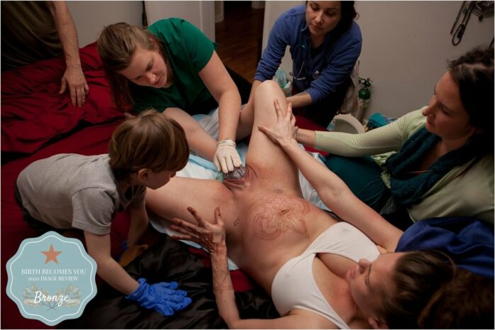 Verloskundige drukt op het hoofdje van de baby die al een stukje uit de vagina steekt