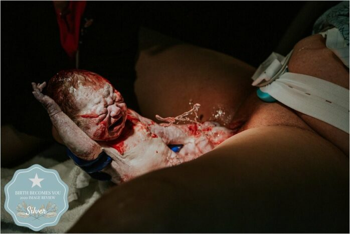 Baby komt uit vagina met vruchtwater om hem heen