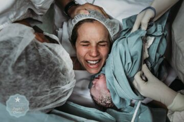 Baby wordt geboren met behulp van een keizersnede