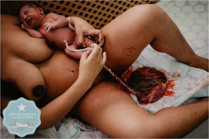 Baby ligt bij moeder op de borst, nog aan de navelstreng en de placenta ernaast