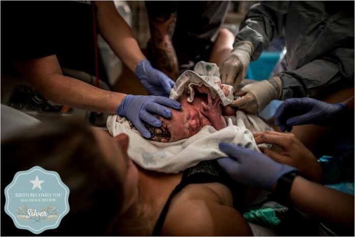 Pasgeboren baby wordt bij moeder gelegd