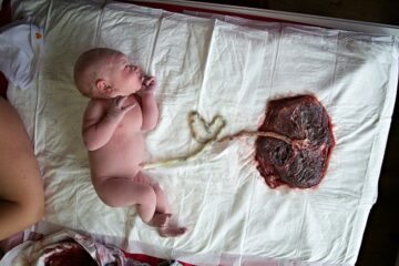 Baby nog vast aan de placenta met de navelstreng