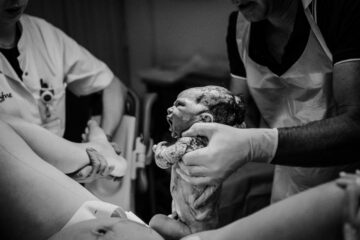 Baby wordt geboren met een vacuümpomp