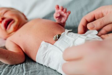 Baby krijgt na geboorte cordring om navelstreng