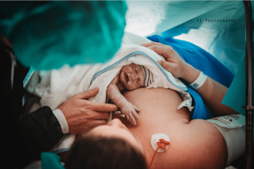 Pasgeboren baby bij gentle sectio