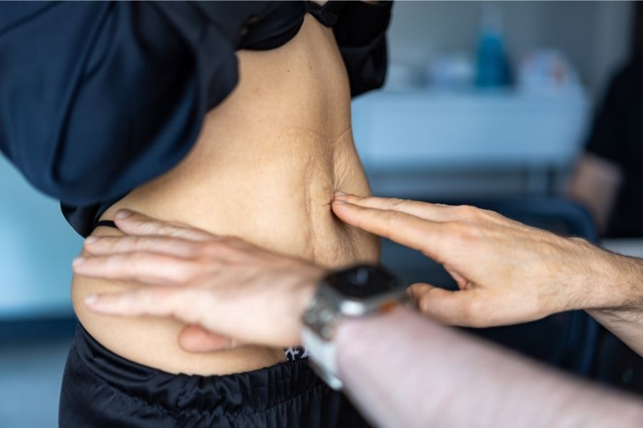 Vrouw heeft diastase na de zwangerschap