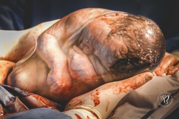 Pasgeboren baby zit nog in foetushouding in de vruchtzak