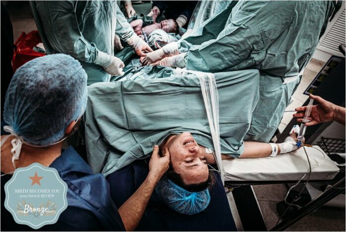 Vrouw kijkt emotioneel nadat haar baby met een keizersnede is gehaald