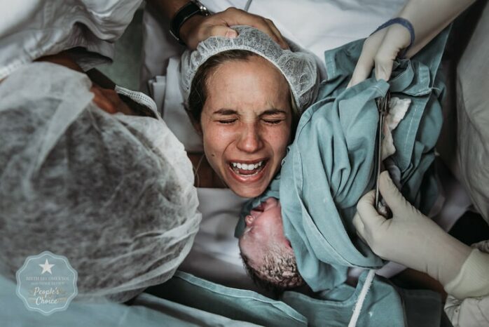 Baby wordt geboren met behulp van een keizersnede