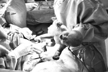 Baby wordt geboren via een keizersnede