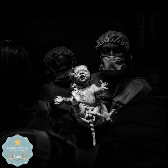 Doktoren houden pasgeboren baby vast