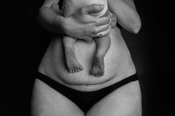 Vrouw houdt baby vast op buik na keizersnede