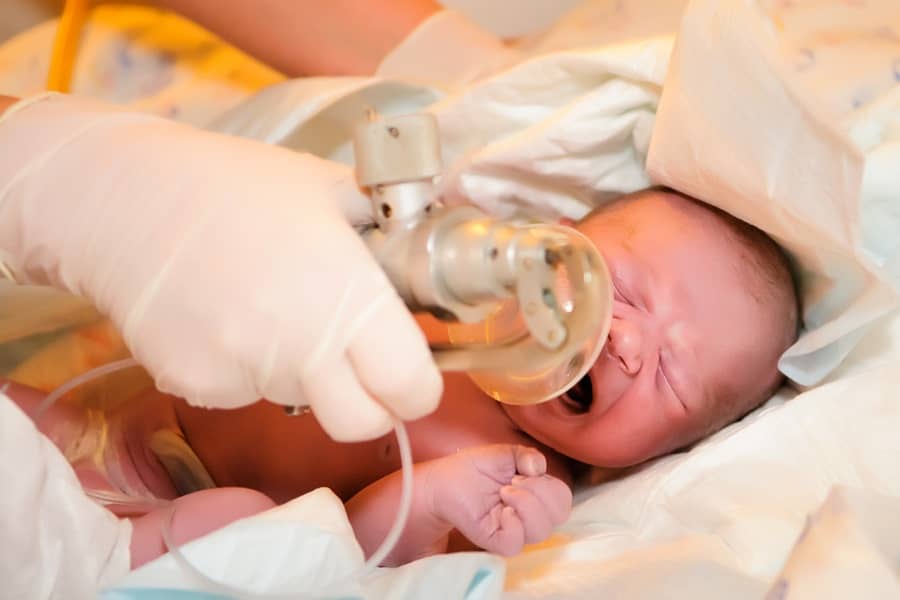 Baby met asfyxie krijgt zuurstof