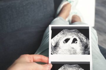 Vrouw is 4 weken zwanger en houdt echo vast