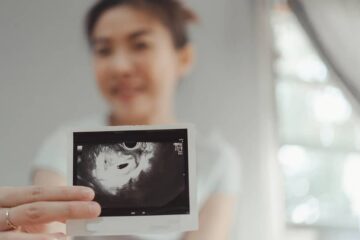 Vrouw heeft echo bij 5 weken gehad