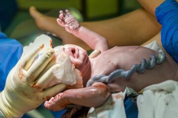 Navelstreng is aan het uitkloppen bij pasgeboren baby