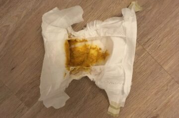 Volle Windel. Das bedeutet der Stuhlgang deines Babys.