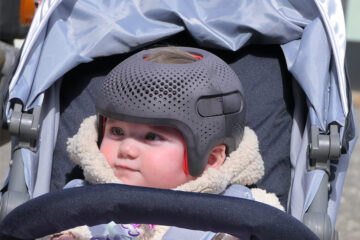 Baby mit Plagiozephalie sitzt im Kinderwagen und trägt einen Helm.