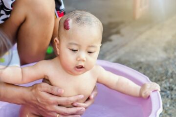 Hämangiome - Baby mit Erdbeerflecken ist am planschen.